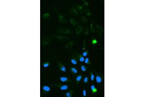 Immunofluorescence analysis of MCF7 cell using UGT1A9 antibody. (UGT1A9 antibody  (AA 26-250))