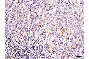 Immunohistochemistry (IHC) image for anti-Dual Specificity Phosphatase 1 (DUSP1) (AA 151-250) antibody (ABIN735368) (DUSP1 antibody  (AA 151-250))