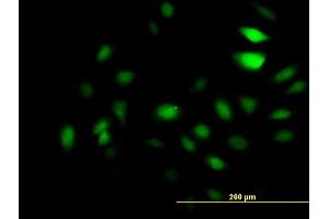 Immunofluorescence of monoclonal antibody to GCN5L2 on HeLa cell. (KAT2A antibody  (AA 738-837))