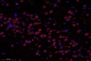 Immunofluorescence (fixed cells) (IF/ICC) image for anti-Sad1 and UNC84 Domain Containing 2 (SUN2) antibody (ABIN7075502)