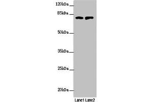 Western blot All lanes: RUFY2 antibody at 1. (RUFY2 antibody  (AA 396-655))