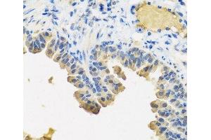 Immunohistochemistry of paraffin-embedded Mouse lung using ANGPT1 Polyclonal Antibody at dilution of 1:100 (40x lens). (Angiopoietin 1 antibody)