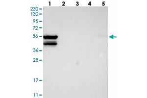 Western blot analysis of Lane 1: RT-4, Lane 2: U-251 MG, Lane 3: Human Plasma, Lane 4: Liver, Lane 5: Tonsil with MKS1 polyclonal antibody .
