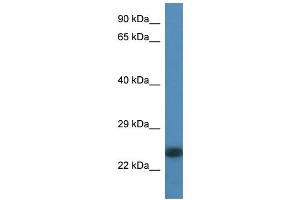 WB Suggested Anti-LOC100359980 Antibody Titration: 1. (LOC100359980 antibody  (N-Term))