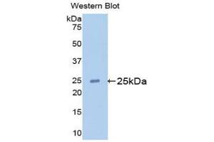 Detection of Recombinant APOM, Mouse using Polyclonal Antibody to Apolipoprotein M (APOM) (Apolipoprotein M antibody  (AA 20-190))