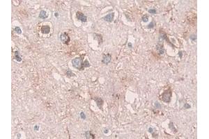 Detection of TPP1 in Human Cerebrum Tissue using Polyclonal Antibody to Tripeptidyl Peptidase I (TPP1)