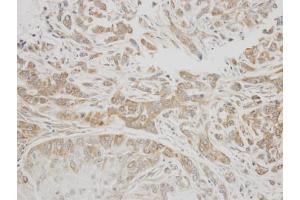 IHC-P Image Immunohistochemical analysis of paraffin-embedded A549 xenograft, using C1 inhibitor, antibody at 1:300 dilution. (SERPING1 antibody  (Center))