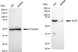 Western blotting analysis using Ku70 antibody (ABIN7800877).