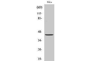 Western Blotting (WB) image for anti-Jun Proto-Oncogene (JUN) (Ser646) antibody (ABIN3183299) (C-JUN antibody  (Ser646))