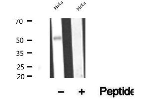 Western blot analysis of extracts of HeLa cells, using BBS4 antibody.