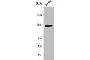 Western Blot analysis of HuvEc cells using MSH3 Polyclonal Antibody (MSH3 antibody  (N-Term))