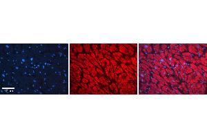 Immunohistochemistry (IHC) image for anti-Nuclear Factor of kappa Light Polypeptide Gene Enhancer in B-Cells Inhibitor, alpha (NFKBIA) (N-Term) antibody (ABIN2792665)