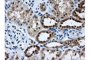 Immunohistochemical staining of paraffin-embedded Kidney tissue using anti-GBE1 mouse monoclonal antibody. (GBE1 antibody)
