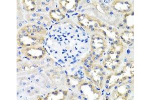 Immunohistochemistry of paraffin-embedded Rat kidney using SCG3 Polyclonal Antibody at dilution of 1:100 (40x lens). (SCG3 antibody)