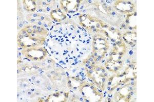 Immunohistochemistry of paraffin-embedded Rat kidney using SCG3 Polyclonal Antibody at dilution of 1:100 (40x lens).