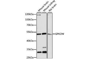 Western blot analysis of extracts of various cell lines, using GPKOW antibody (ABIN6293325) at 1:3000 dilution. (GPKOW antibody)
