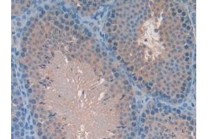 Detection of MAPK7 in Mouse Testis Tissue using Polyclonal Antibody to Mitogen Activated Protein Kinase 7 (MAPK7) (MAPK7 antibody  (AA 185-419))