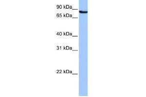 WB Suggested Anti-UBQLN3 Antibody Titration: 0. (Ubiquilin 3 antibody  (N-Term))
