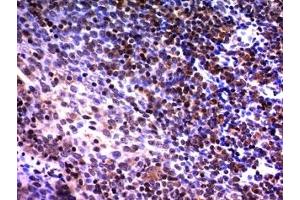 Formalin-fixed, paraffin-embedded human tonsil stained with NuMA antibody (A73-B/D12)