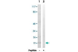 Western blot analysis of extracts from K-562 cells, using MRPL51 polyclonal antibody .