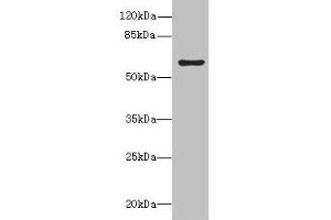 Western blot All lanes: KHDC4 antibody at 5 μg/mL + Mouse liver tissue Secondary Goat polyclonal to rabbit IgG at 1/10000 dilution Predicted band size: 65, 60, 41, 25 kDa Observed band size: 65 kDa (UPF0469 Protein KIAA0907 (KHDC4) (AA 1-241) antibody)