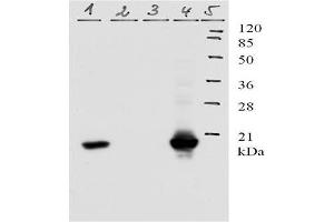 Picture: Western-Blot analysis of HPV-11 E7 protein. (Human Papilloma Virus 11 E7 (HPV-11 E7) (AA 1-35) antibody)