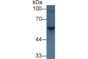 Western blot analysis of Rat Serum, using Rat SHH Antibody (1 µg/ml) and HRP-conjugated Goat Anti-Rabbit antibody (