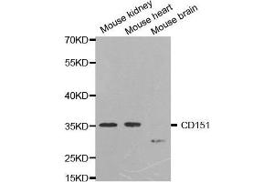 Western blot analysis of extracts of various cell lines, using CD151 antibody. (CD151 antibody  (AA 113-221))