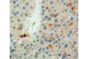 Used in DAB staining on fromalin fixed paraffin-embedded liver tissue (LDHB antibody  (AA 1-334))
