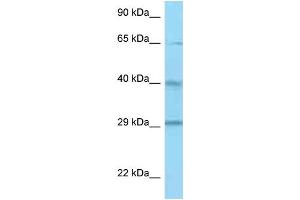 Western Blotting (WB) image for anti-Complement Factor H-Related 1 (CFHR1) (C-Term) antibody (ABIN2789086)