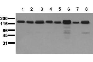 Western Blotting (WB) image for anti-Met Proto-Oncogene (MET) (Activation Domain) antibody (ABIN492622) (c-MET antibody  (Activation Domain))