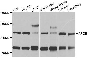 Western blot analysis of extracts of various cell lines, using APOB antibody.