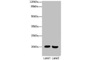 Western blot All lanes: MSRB2antibody at 2. (MSRB2 antibody  (AA 10-182))