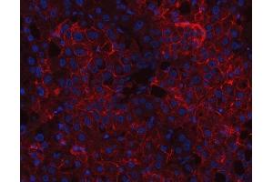 IF analysis of CD166/ALCAM using anti-CD166/ALCAM antibody (ABIN5518801).