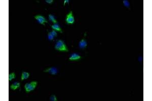 Immunofluorescence staining of U251 cells with ABIN7139867 at 1:50, counter-stained with DAPI. (GNG2 antibody  (AA 44-62))
