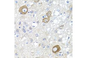 Immunohistochemistry of paraffin-embedded rat brain using NRG4 antibody (ABIN1873958) at dilution of 1:100 (40x lens). (Neuregulin 4 antibody)