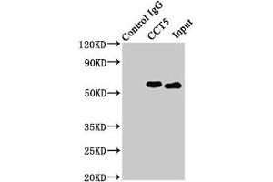 Immunoprecipitating CCT5 in Hela whole cell lysate Lane 1: Rabbit control IgG (1 μg) instead of ABIN7171417 in Hela whole cell lysate. (CCT5 antibody  (AA 1-270))