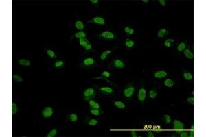 Image no. 6 for anti-Cytidine Monophosphate N-Acetylneuraminic Acid Synthetase (CMAS) (AA 164-264) antibody (ABIN466224) (CMAS antibody  (AA 164-264))