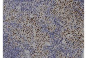 ABIN6265185 and ABIN6277766 at 1/100 staining Mouse spleen tissue by IHC-P.