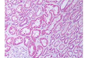 Anti-TNFR2 antibody IHC of human kidney, tubules. (TNFRSF1B antibody)