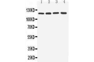 Anti-TLR7 antibody, Western blotting Lane 1: Rat Spleen Tissue Lysate Lane 2: Rat Liver Tissue Lysate Lane 3: U87 Cell Lysate Lane 4: A549 Cell Lysate (TLR7 antibody  (C-Term))