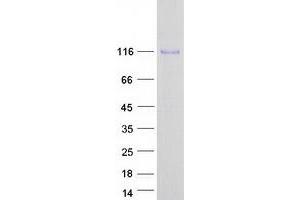 Validation with Western Blot (ENPP3 Protein (Myc-DYKDDDDK Tag))
