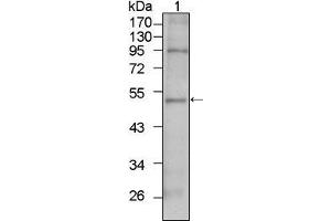 Western Blot showing TBX5 antibody used against HepG2 cell lysate (1).