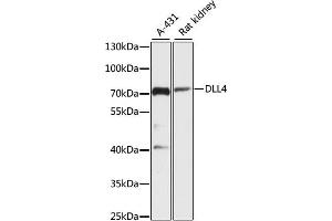 Western blot analysis of extracts of various cell lines, using DLL4 antibody (ABIN6127753, ABIN6139662, ABIN6139663 and ABIN6216765) at 1:3000 dilution. (DLL4 antibody  (AA 317-530))