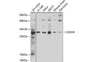 Western blot analysis of extracts of various cell lines, using SCN1B antibody (ABIN6132634, ABIN6147433, ABIN6147434 and ABIN6214194) at 1:1000 dilution. (SCN1B antibody  (AA 19-160))