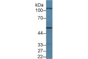 Western Blot; Sample: Porcine Skeletal muscle lysate; Primary Ab: 2µg/ml Rabbit Anti-Human MYPN Antibody Second Ab: 0. (Myopalladin antibody  (AA 945-1320))