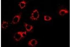 Immunofluorescent analysis of S100-A11 staining in SKOV3 cells. (S100A11 antibody)