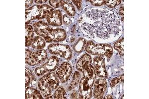 Immunohistochemical staining of human kidney with CMC1 polyclonal antibody  shows strong cytoplasmic positivity in cells in tubules.