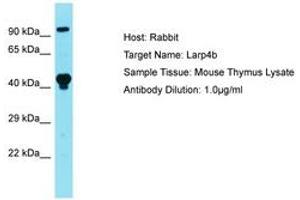 Image no. 1 for anti-La Ribonucleoprotein Domain Family, Member 4B (LARP4B) (AA 141-190) antibody (ABIN6750303) (LARP4B antibody  (AA 141-190))