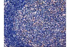 Image no. 6 for anti-UDP-Galactose-4-Epimerase (GALE) antibody (ABIN1498366)